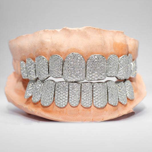 Custom VVS Moissanite Diamond Grillz